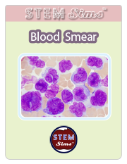 Blood Smear Brochure's Thumbnail